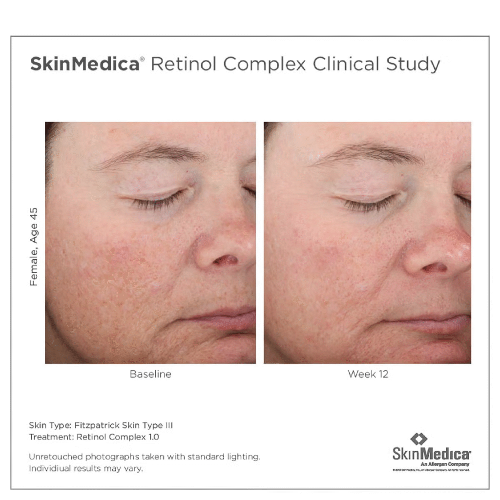 SkinMedica Retinol 1.0 Complex