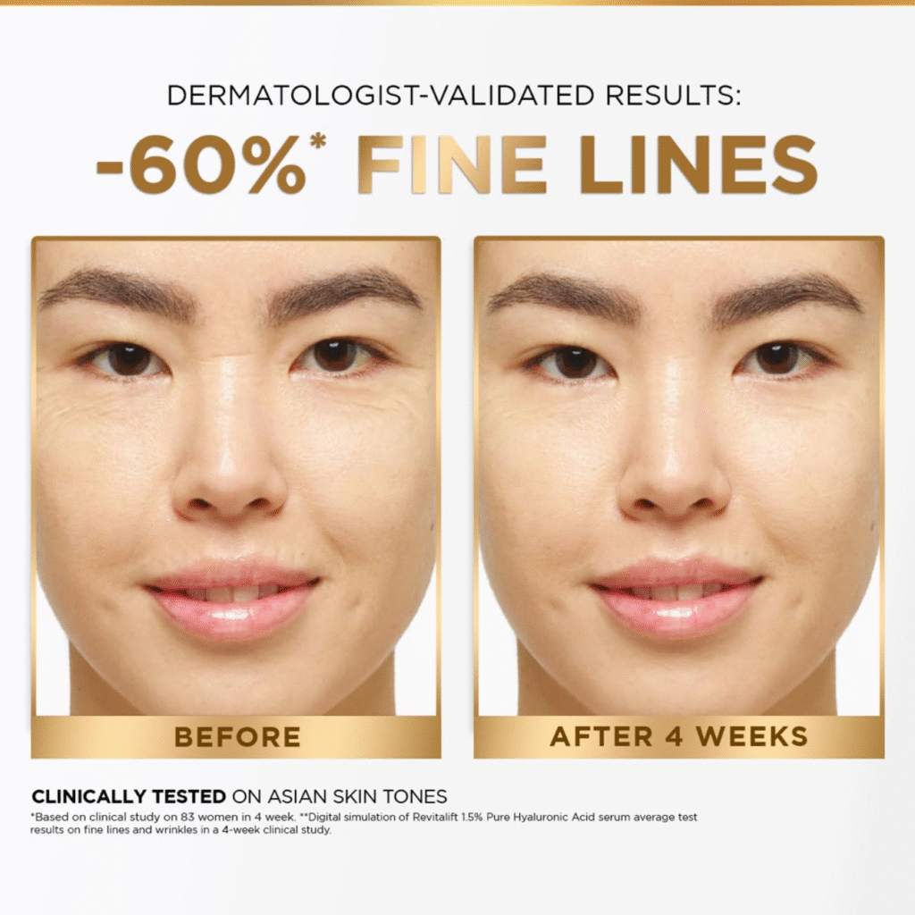L'Oréal Revitalift 1.5% Hyaluronic Acid Serum Review (2026): Is This Amazing Plumper Sticky? 2 L'Oréal Revitalift 1.5% Hyaluronic Acid Serum