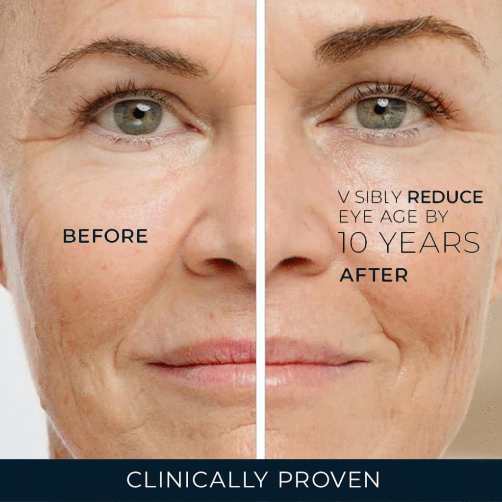 RoC Retinol Correxion Under Eye Cream