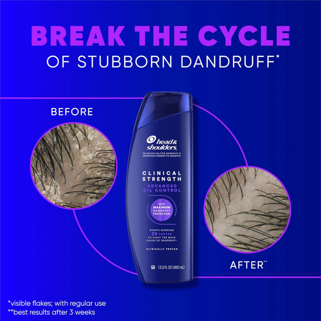 Head & Shoulders Clinical Strength Review (2026): An *Honest* Warning 2 image 178 Vanity Reviews